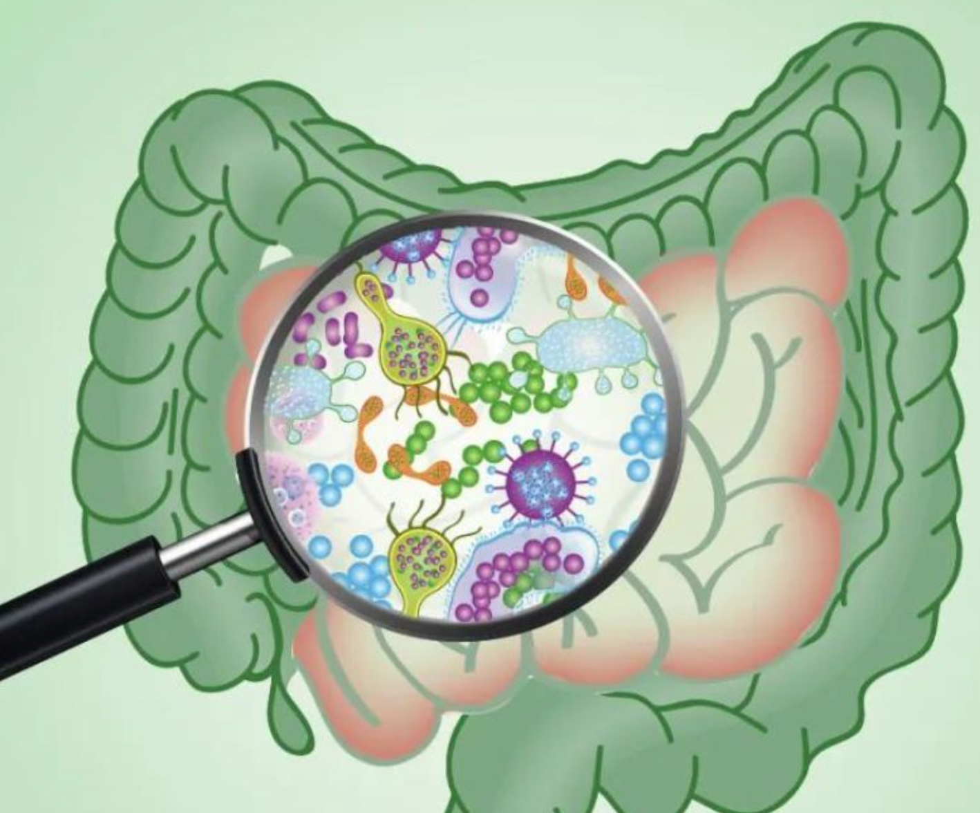 SIBO — What It Is, Why Your IBS Diagnosis Is Probably Wrong, and the 90-Day Protocol That Actually Works