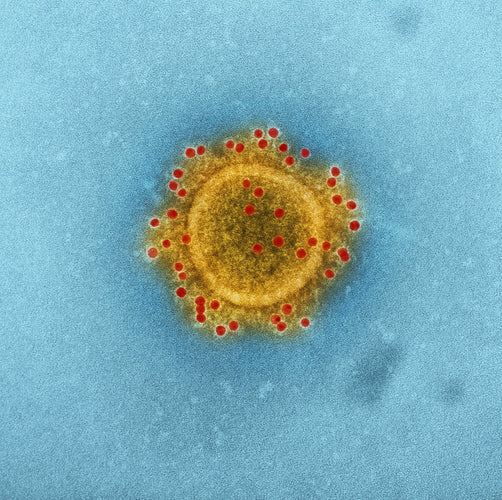 Do Countries Outside the USA, Regularly Detox from Parasites?