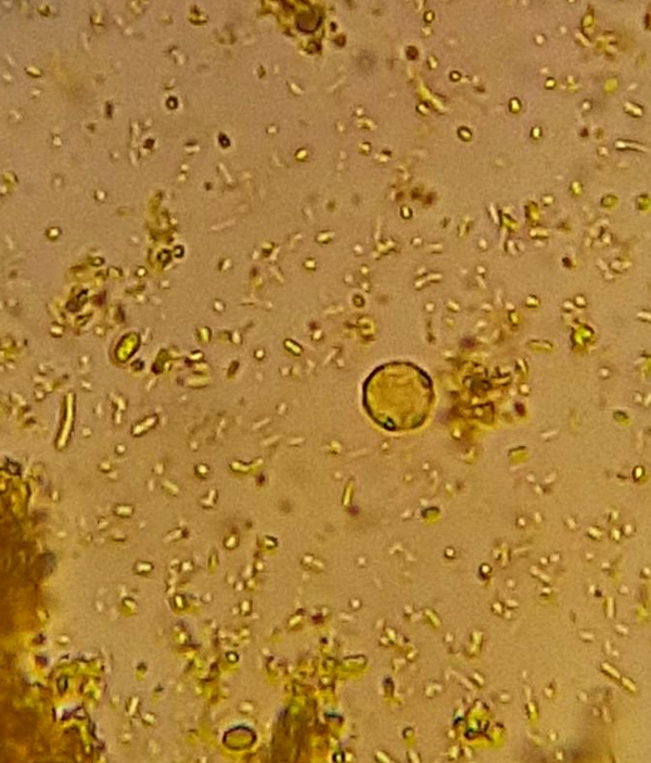 Blastocystis