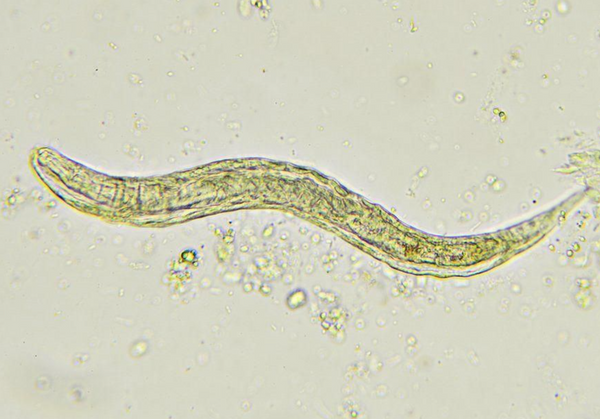Pinworm