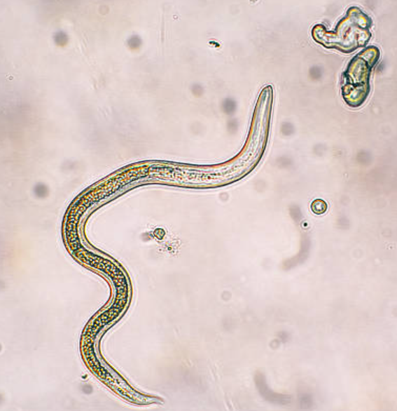Roundworm