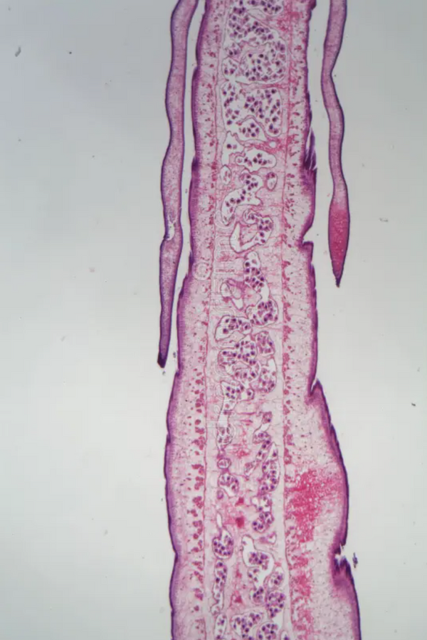 Tapeworm