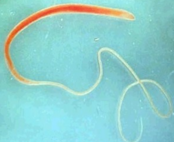 Whipworm